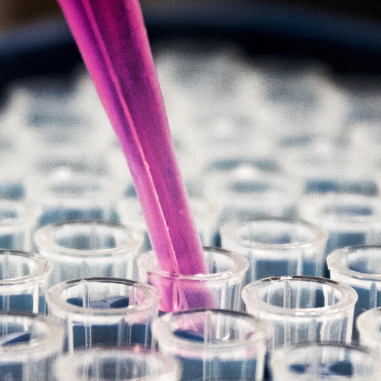 Image of a pipette and test tubes