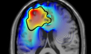 An x-ray image of the brain