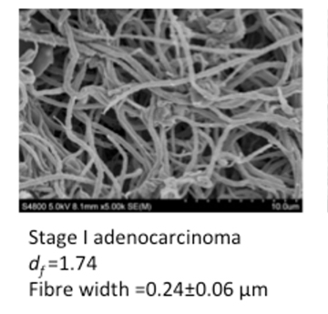 Clot Microstructure and Sepsis