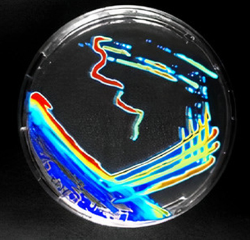 light-producing tumour-targeting bacteria