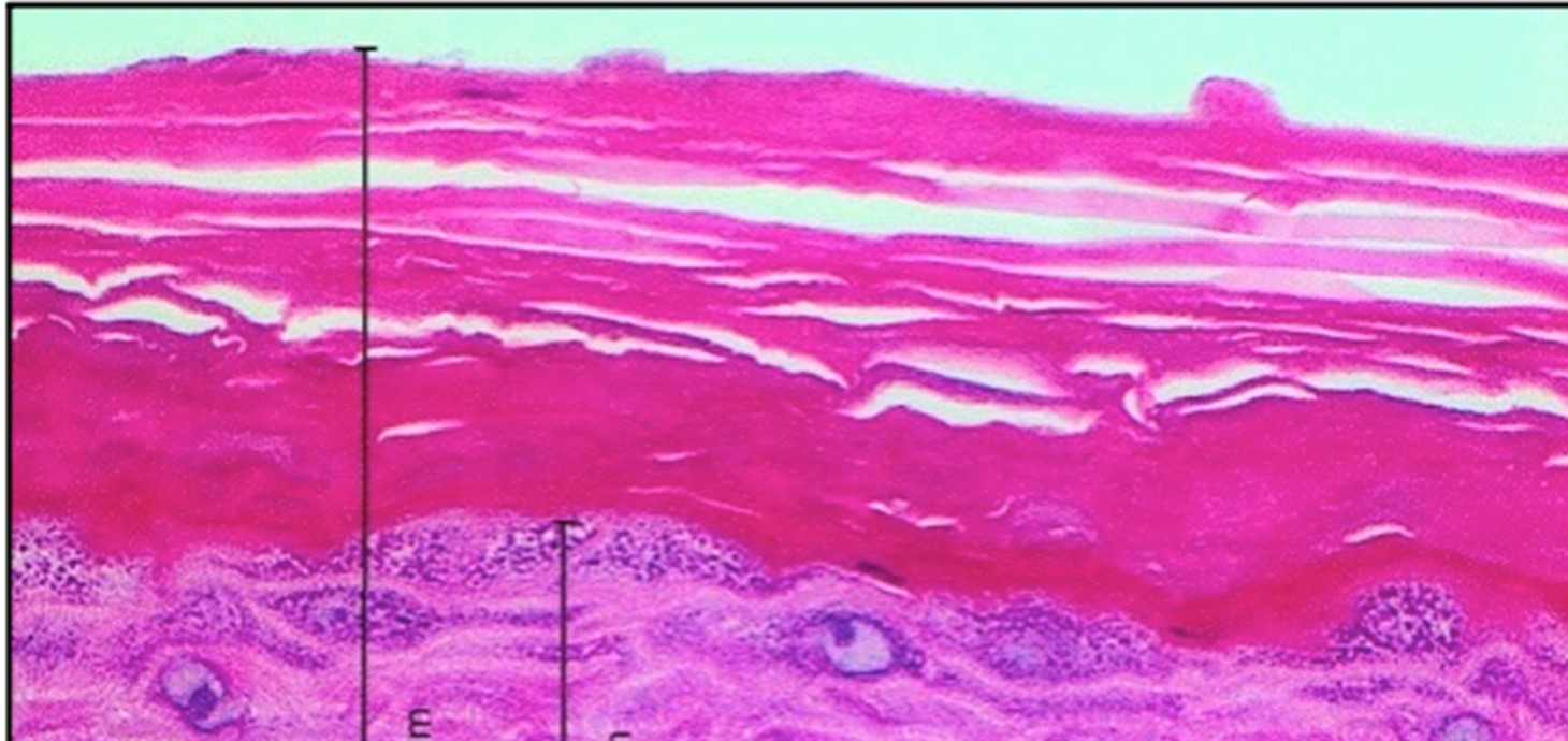 Cross-section through reconstructed human skin, cultured in the laboratory, used to test the safety of products applied to the skin. Research by the Swansea-led CALIN project, which works closely with companies. 